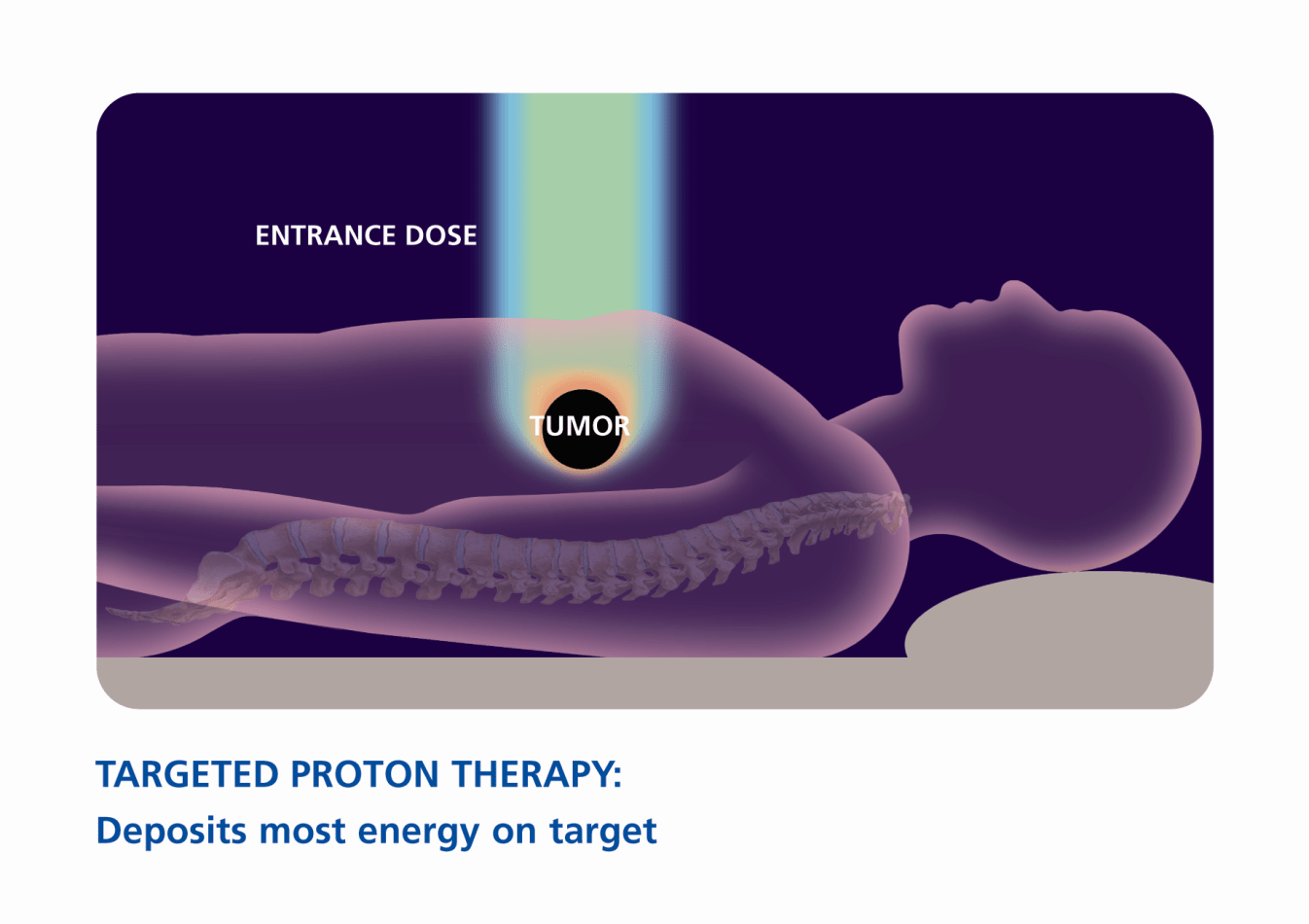 Proton Therapy Image