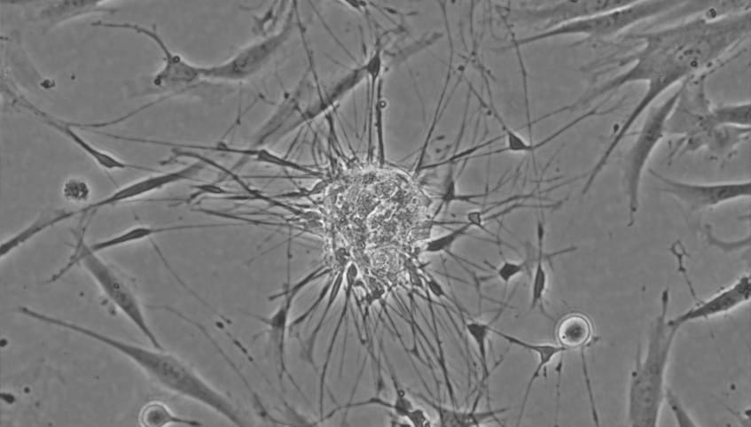 Magnified black and white image of primary skin fibroblasts being prepared for expansion