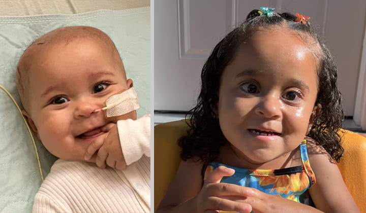 Side-by-side before-and-after photos of a pediatric proton therapy patient. The left image shows an infant with a nasal feeding tube. The right image shows the same child at an older age, seated indoors without medical equipment, illustrating the child's progress since treatment.