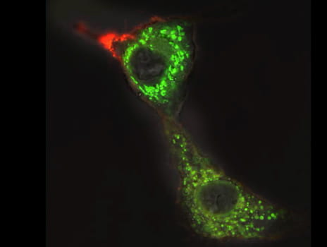Microscope image of therapeutic peptide glioblastoma